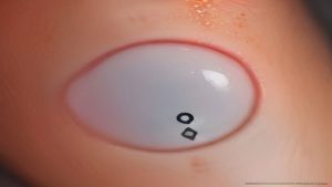 Best Tranexamic Acid Serum For Hyperpigmentation 2026