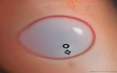 Best Tranexamic Acid Serum For Hyperpigmentation 2026