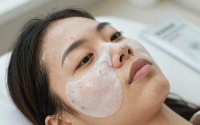 The Best Acne Patches of 2026, Compared on Real Breakouts